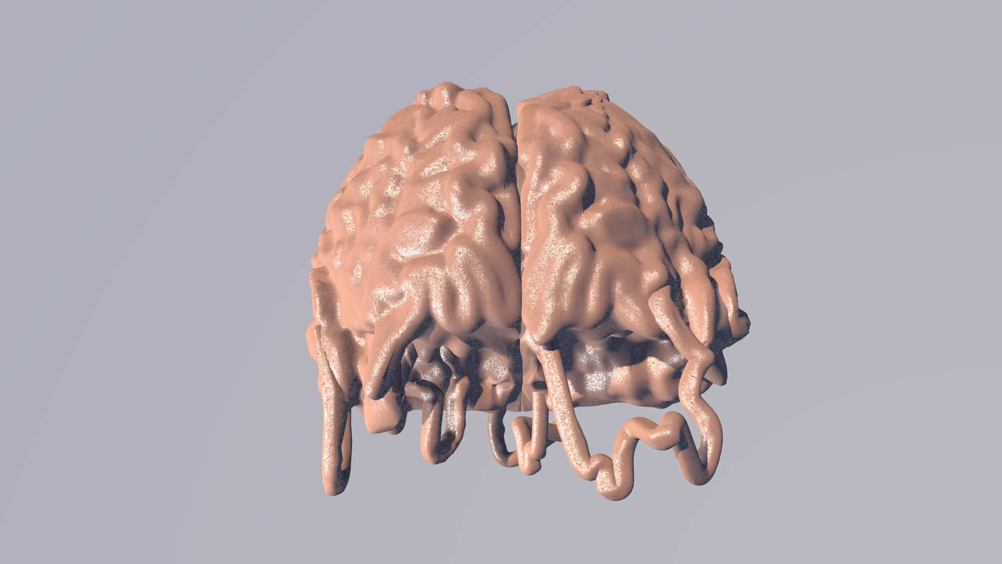 3D animation of a frazzled brain. 