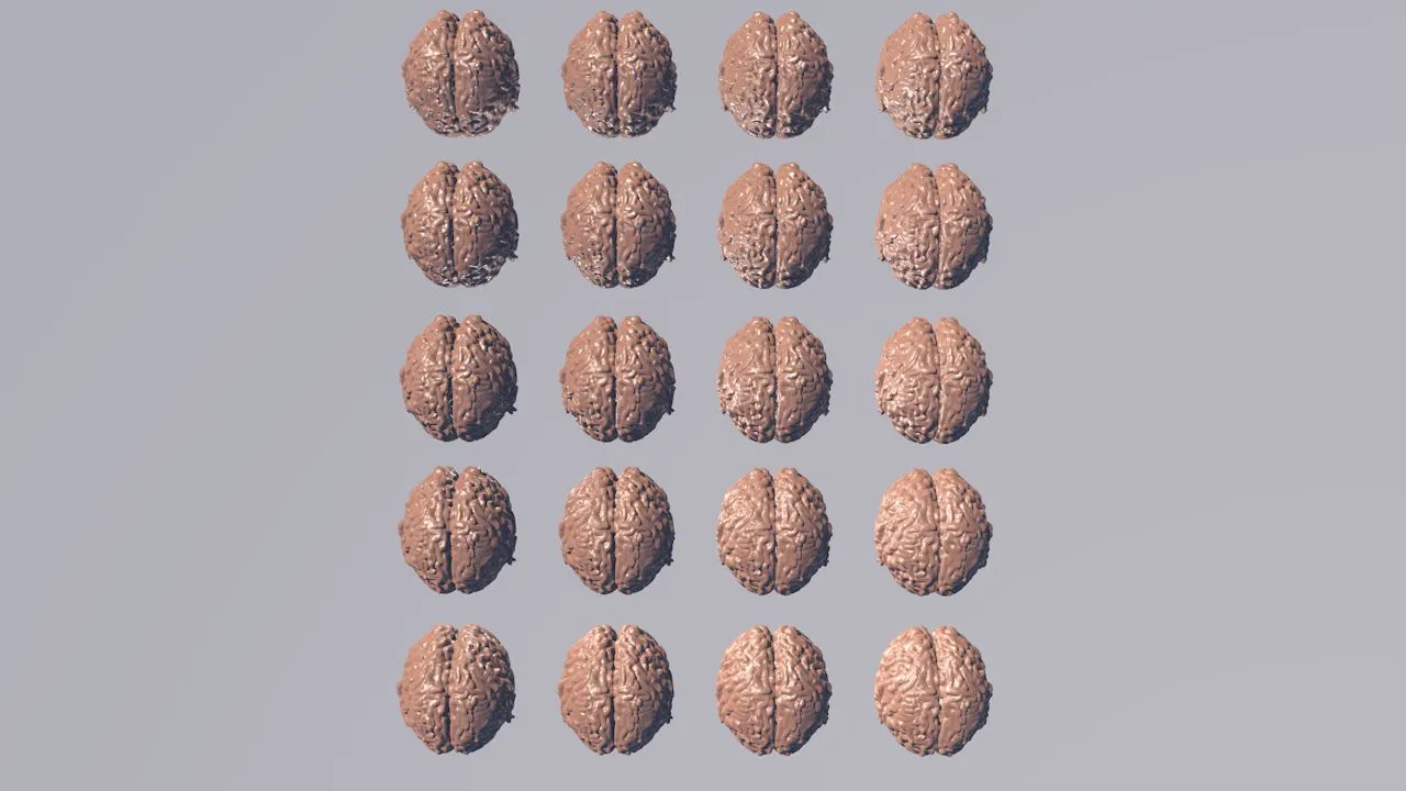 3D animation of a brain.