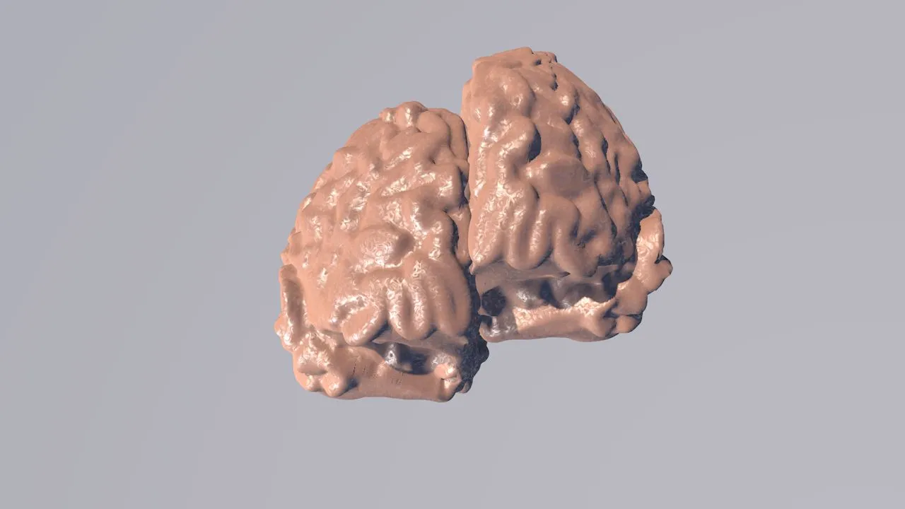 3D animation of a brain.